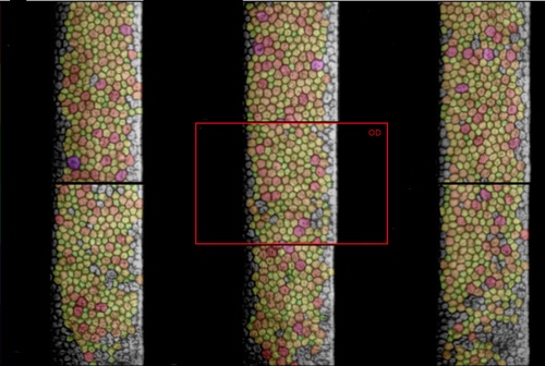 Besser Sehen Landshut - Analyse der hinteren Zellschicht Ihrer Hornhaut